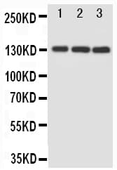 Polyclonal Rabbit anti-Human MAP3K1 / MEKK1 Antibody (aa1418-1432, IHC, WB)