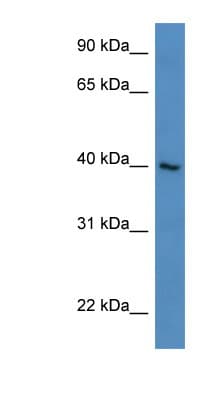 Polyclonal Rabbit anti-Human ZNF821 Antibody (N-Terminus, WB)
