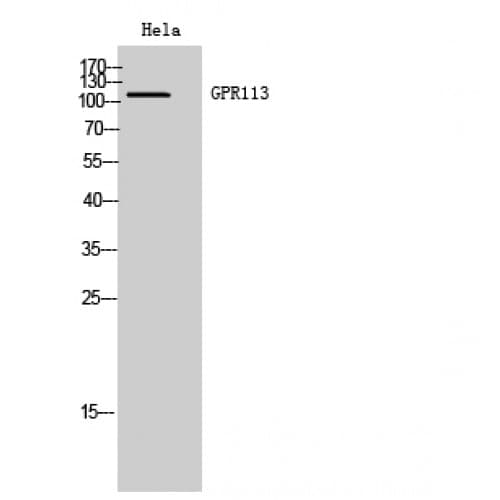 ADGRF3 / GPR113 Antibody (370-450 aa, N-terminal)