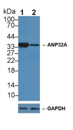 PHAP1 / ANP32A Antibody (aa2-249)