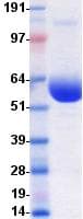 Human PD-L2 / PDCD1LG2 / CD273 Protein (Recombinant Fc, C-terminus)