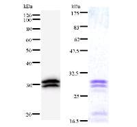 TARS Antibody (clone TARSF8H3)