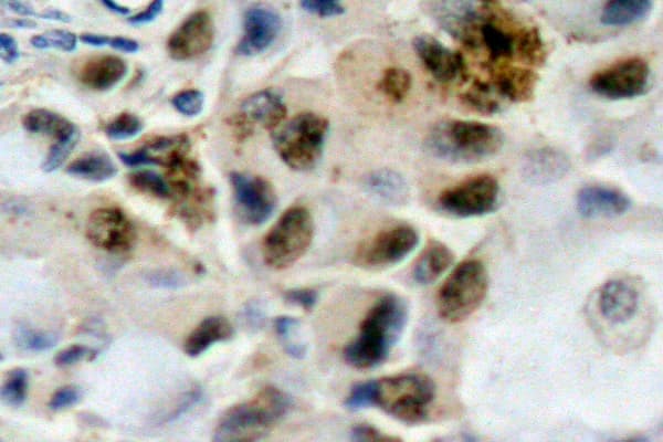 Polyclonal Rabbit anti-Human FOXO4 / AFX1 Antibody (Pro191, IHC, WB)