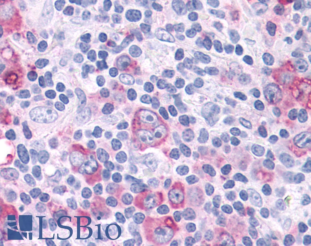 PathPlus™ Polyclonal Rabbit anti-Human RORC / ROR Gamma Antibody (Ligand-binding Domain, IHC)