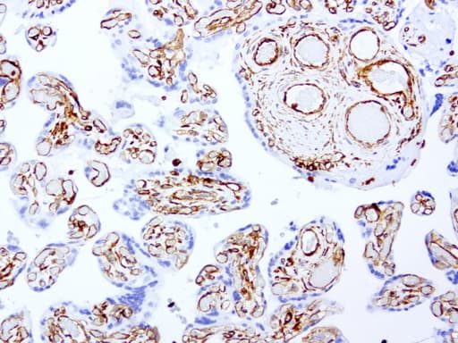 Vimentin Antibody (clone UMAB160, Carrier-free)