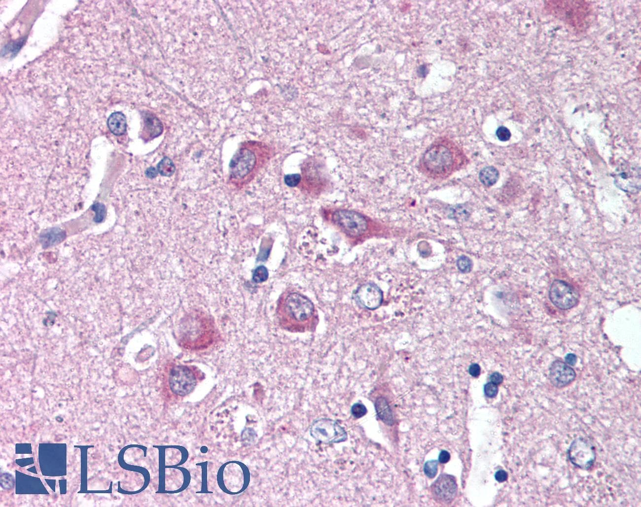 IHC-plus™ WNT14 / WNT9A Antibody (N-Terminus)