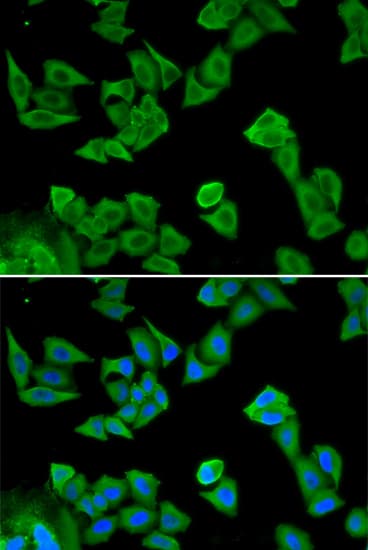 Polyclonal Rabbit anti-Human SMAD4 Antibody (IHC, IF, WB)