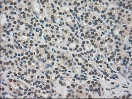 TRIB2 Antibody (clone OTI8D11)