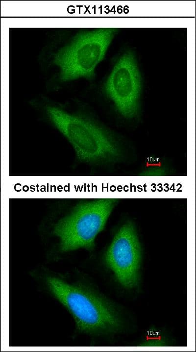 IHC-plus™ HPRT1 / HPRT Antibody (aa23-218)