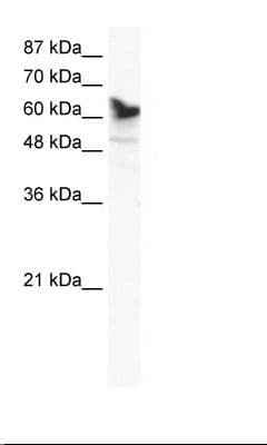 DDX41 / ABS Antibody (aa447-496)