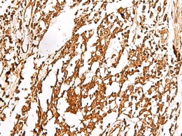TRF1 / TERF1 Antibody