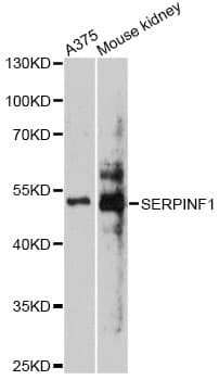 SERPINF1 / PEDF Antibody