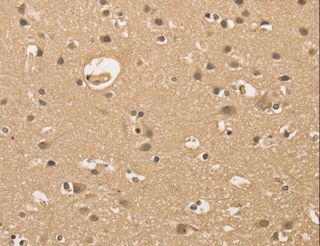ALDH8A1 Antibody