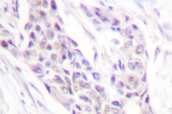 Polyclonal Rabbit anti-Human CCNA1 / Cyclin A1 Antibody (Arg436, IHC, WB)