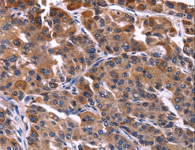NFAT4 / NFATC3 Antibody