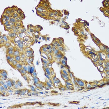 Polyclonal Rabbit anti-Human SLC25A13 / CITRIN Antibody (IHC, IF, WB)