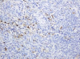 TP / Thymidine Phosphorylase Antibody (aa311-482, clone OTI1E7, Carrier-free)