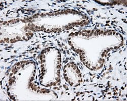 p66 / SHC Antibody (clone OTI3A1)