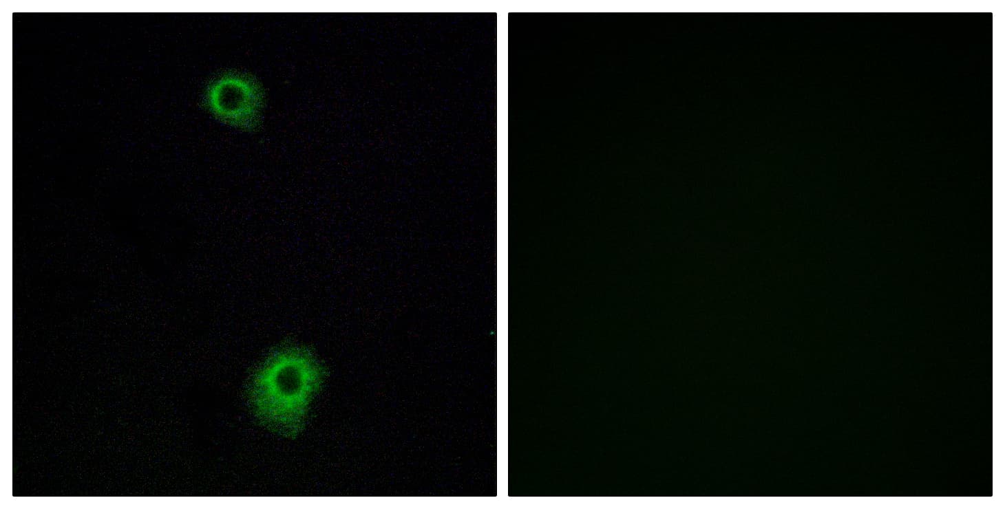 HTR1B / 5-HT1B Receptor Antibody (aa261-310)