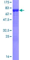 Human SCIN Protein (Recombinant GST)