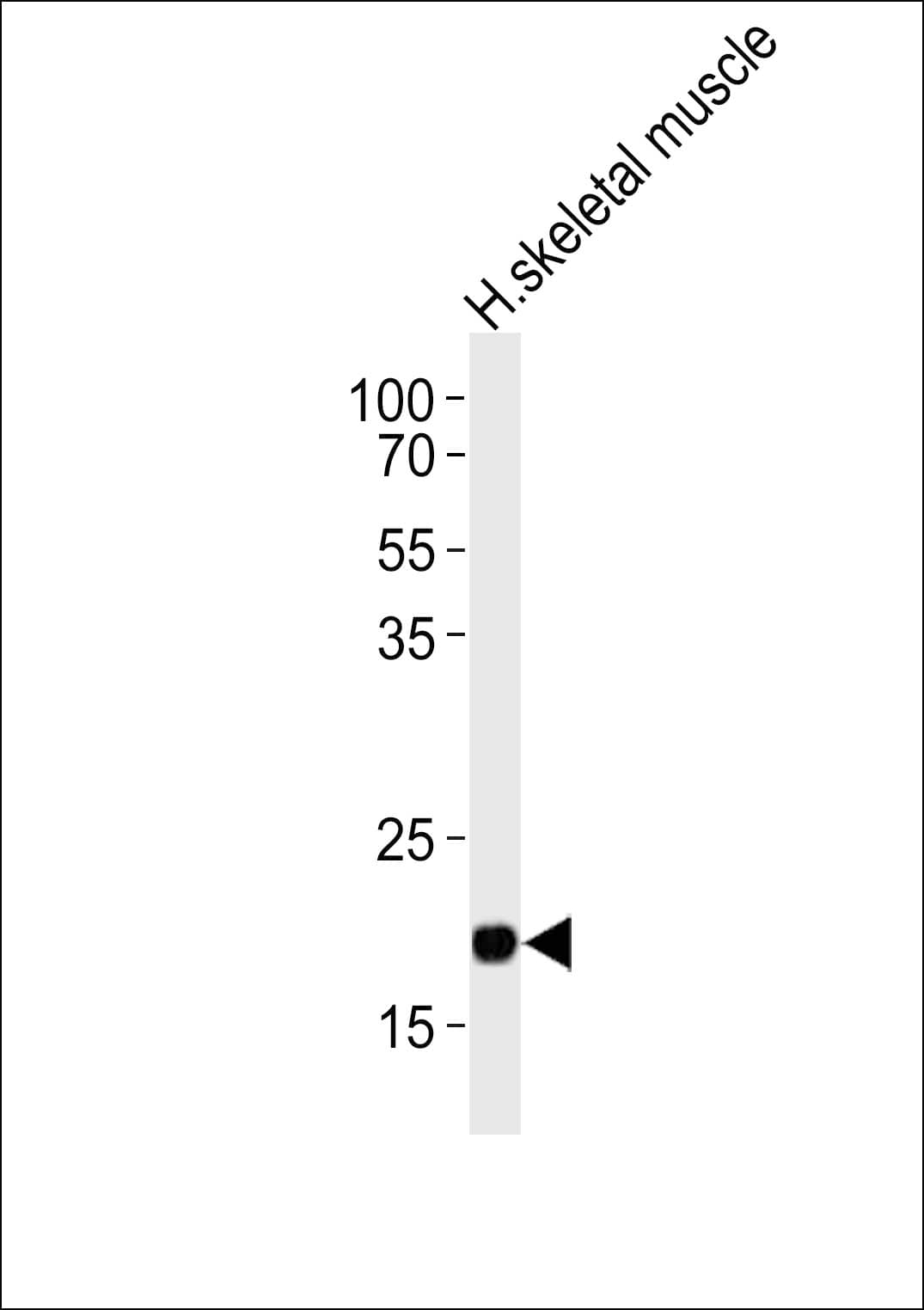 COX6A2 Antibody (aa37-66)