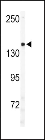 Polyclonal Rabbit anti-Human ULK2 Antibody (aa612-643, WB)