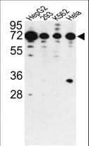 IHC-plus™ Polyclonal Rabbit anti-Human PHACTR2 Antibody (aa169-198, IHC, WB)