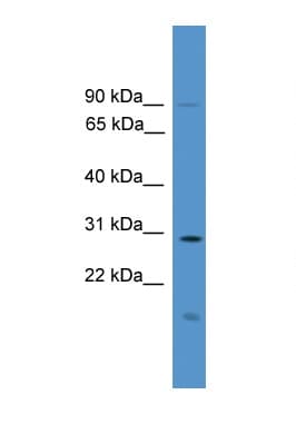 RASSF1 / RASSF1A Antibody (aa201-250)