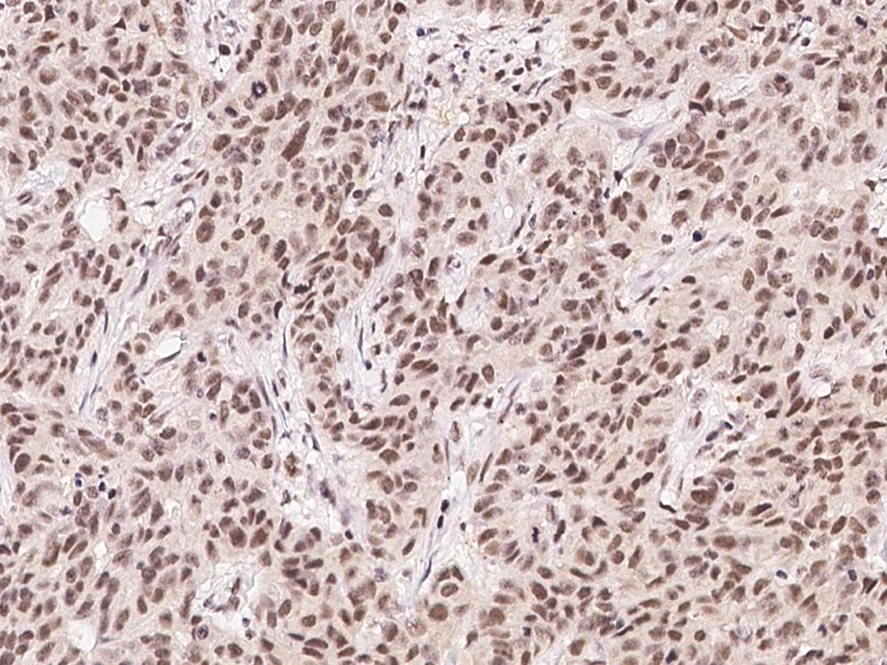 FOXK1 / MNF Antibody