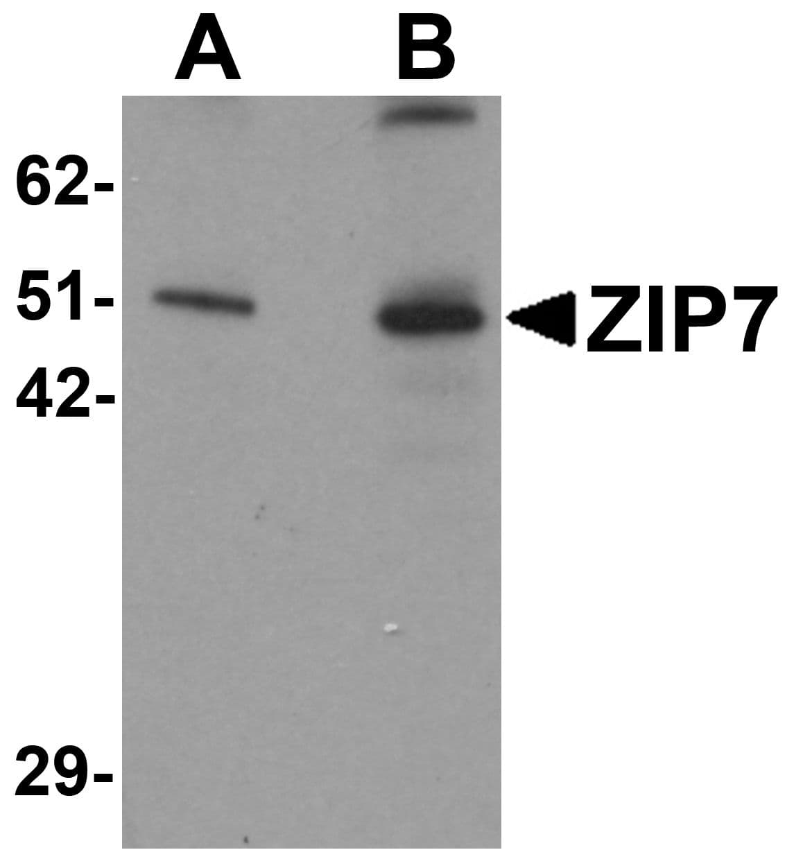IHC-plus™ Polyclonal Rabbit anti-Human SLC39A7 / ZIP7 Antibody (IHC, IF, WB)