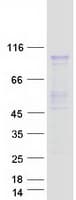 Human PRMT9 / PRMT10 Protein (Recombinant Myc-DDK (Flag))