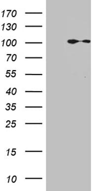 MLH1 Antibody (aa1-298, clone OTI4B5)