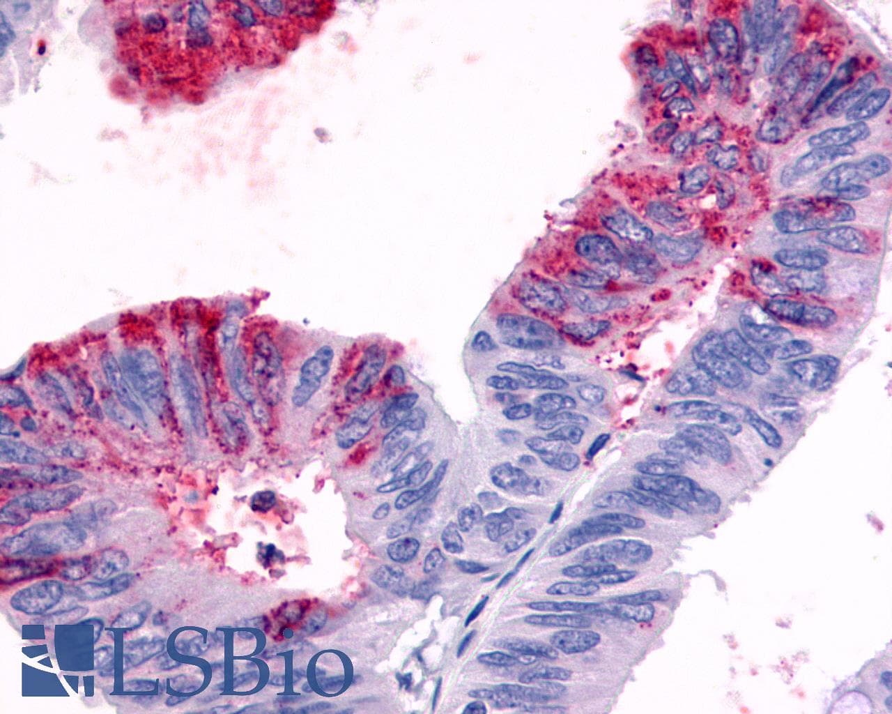 PathPlus™ GPR119 Antibody (Cytoplasmic Domain)