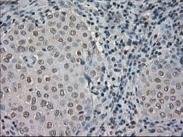 NTRK3 / TRKC Antibody (clone OTI24B3)