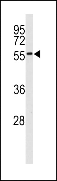 MKNK2 / MNK2 Antibody (aa402-432)