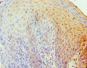 TRAIL-R4 / DCR2 Antibody (aa257-386)