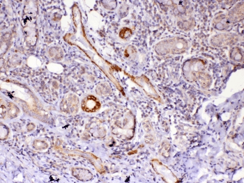 FZD4 / Frizzled 4 Antibody