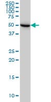 UGP2 Antibody (clone 3H3)