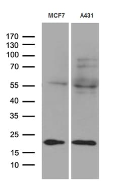 TIM23 Antibody (clone OTI2F5)
