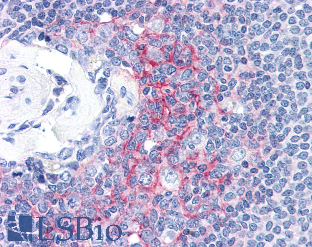 IHC-plus™ ICAM-1 / CD54 Antibody