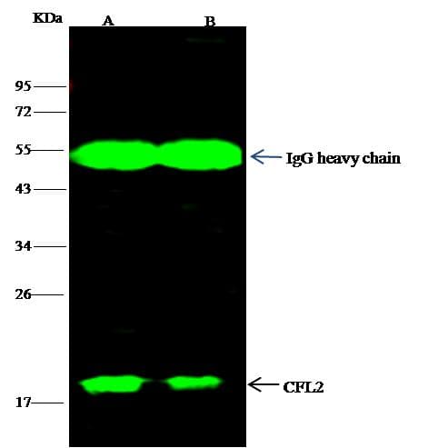 CFL2 / Cofilin 2 Antibody (Preservative Free)