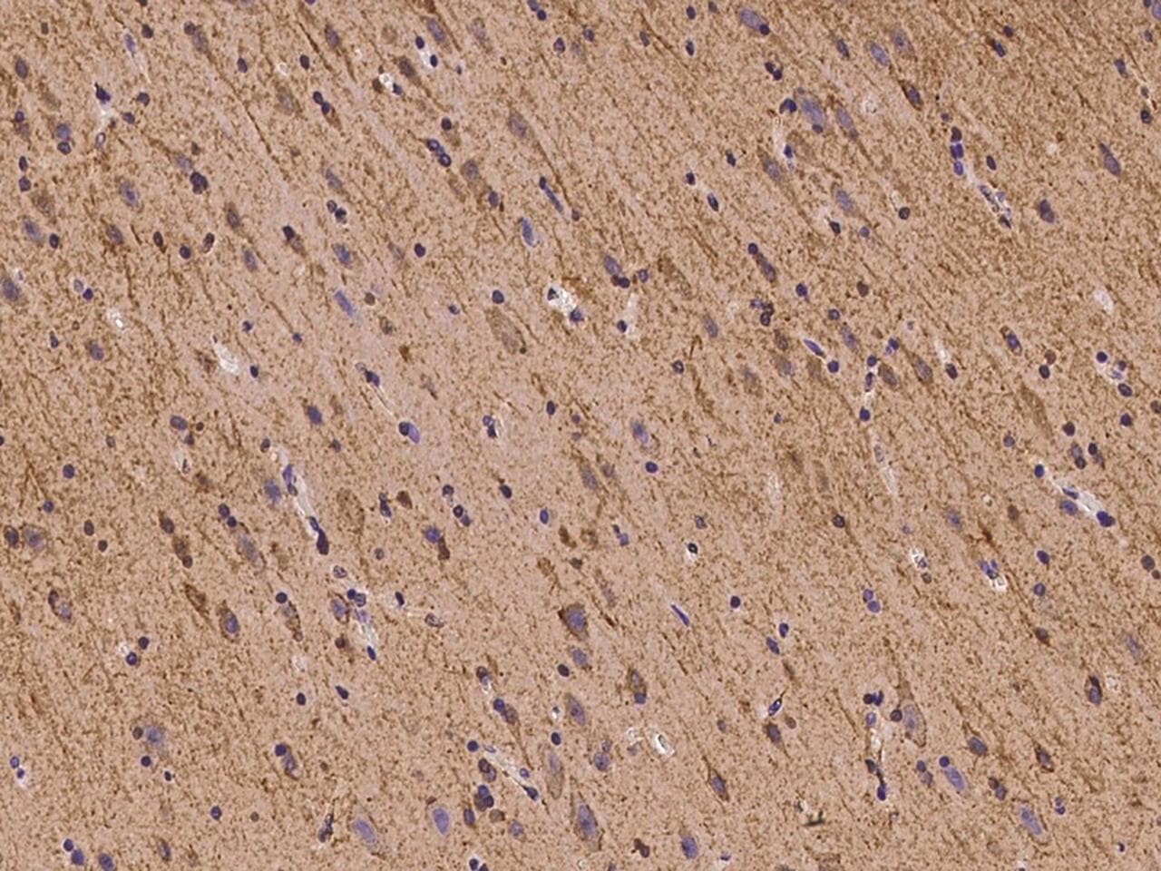 Polyclonal Rabbit anti-Human FLRT1 Antibody (IHC, IF)