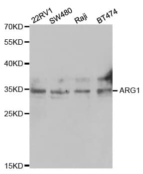 IHC-plus™ ARG1 / Arginase 1 Antibody