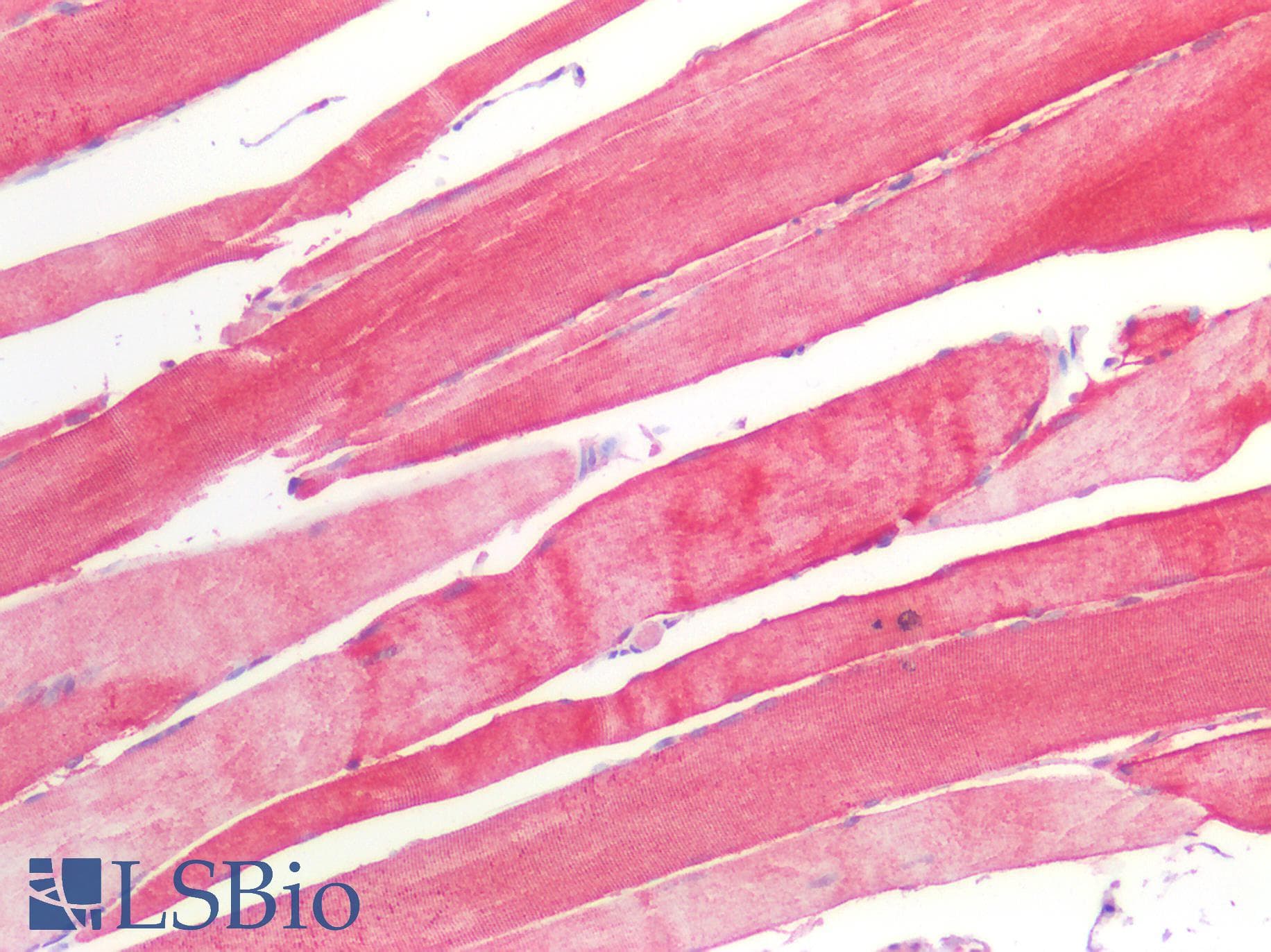 PathPlus™ Monoclonal Mouse anti-Human HSPB1 / HSP27 Antibody (IHC, WB)
