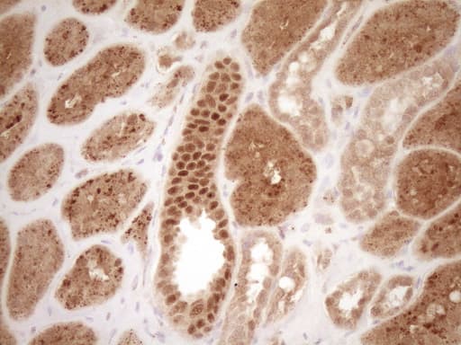 Monoclonal Mouse anti-Human GFI1 Antibody (clone OTI6E8, aa1-180, IHC, WB)
