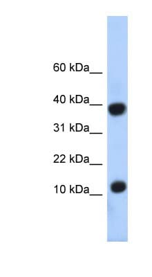 Polyclonal Rabbit anti-Human PCBD1 / PHS Antibody (N-Terminus, WB)