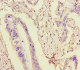 TDRD3 Antibody