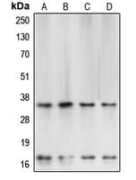 Polyclonal Rabbit anti-Human CASP3 / Caspase 3 Antibody (Internal, IHC, IF, WB)