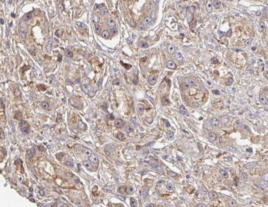PTEN Antibody