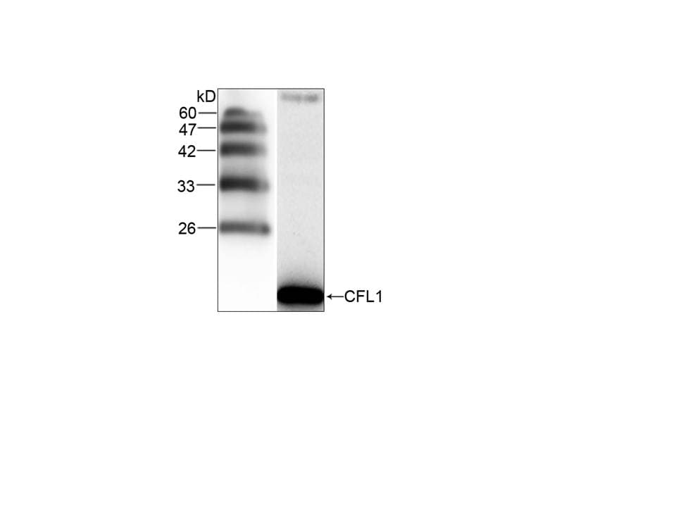 Monoclonal Mouse anti-Human CFL1 / Cofilin Antibody (WB)